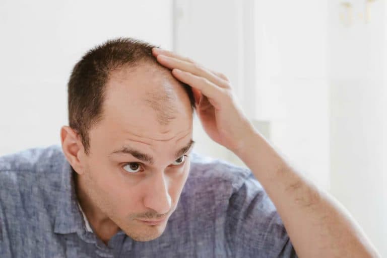 Everything You Need to Know About The New Hair Loss Treatment PP405